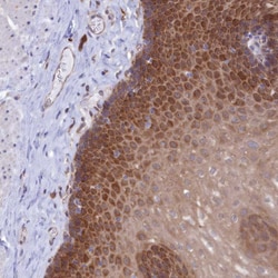 Invitrogen TMEM90A Polyclonal Antibody 100 &mu;L; Unconjugated:Antibodies,