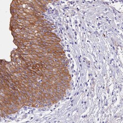 Invitrogen GK5 Polyclonal Antibody 100 &mu;L; Unconjugated:Antibodies,