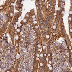 Invitrogen RPIA Polyclonal Antibody 100 &mu;L; Unconjugated:Antibodies,