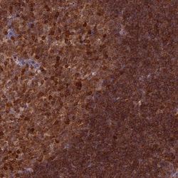 Invitrogen RPIA Polyclonal Antibody 100 &mu;L; Unconjugated:Antibodies,