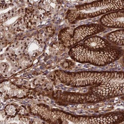 Invitrogen RBBP8NL Polyclonal Antibody 100 &mu;L; Unconjugated:Antibodies,