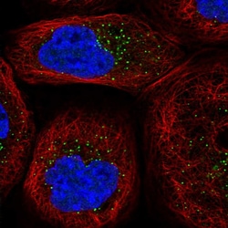 WDR83 Polyclonal Antibody:Antibodies, Polyclonal