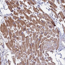 WDR83 Polyclonal Antibody:Antibodies, Polyclonal