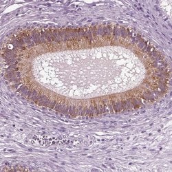 Invitrogen DEFB118 Polyclonal Antibody 100 &mu;L; Unconjugated:Antibodies,