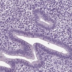 Invitrogen DEFB118 Polyclonal Antibody 100 &mu;L; Unconjugated:Antibodies,