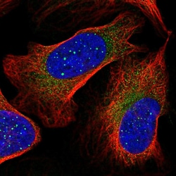 Invitrogen RARS2 Polyclonal Antibody 100 &mu;L; Unconjugated:Antibodies,