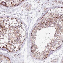 Invitrogen RARS2 Polyclonal Antibody 100 &mu;L; Unconjugated:Antibodies,
