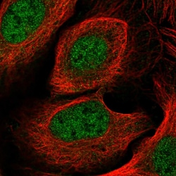 Invitrogen CYB5RL Polyclonal Antibody 100 &mu;L; Unconjugated:Antibodies,