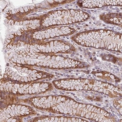 Invitrogen CYB5RL Polyclonal Antibody 100 &mu;L; Unconjugated:Antibodies,