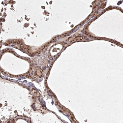 Invitrogen ING5 Polyclonal Antibody 100 &mu;L; Unconjugated:Antibodies,