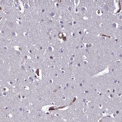 Invitrogen CLEC11A Polyclonal Antibody 100 &mu;L; Unconjugated:Antibodies,