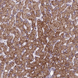 Invitrogen CLEC11A Polyclonal Antibody 100 &mu;L; Unconjugated:Antibodies,