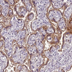 Invitrogen CLEC11A Polyclonal Antibody 100 &mu;L; Unconjugated:Antibodies,