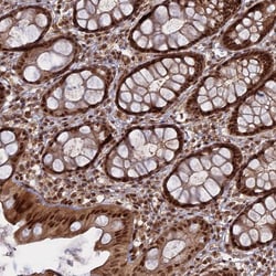 Invitrogen PKIG Polyclonal Antibody 100 &mu;L; Unconjugated:Antibodies,