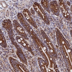Invitrogen DTYMK Polyclonal Antibody 100 &mu;L; Unconjugated:Antibodies,