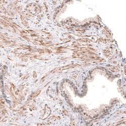 Invitrogen SMC6 Polyclonal Antibody 100 &mu;L; Unconjugated:Antibodies,