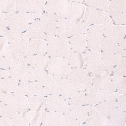 Invitrogen SMC6 Polyclonal Antibody 100 &mu;L; Unconjugated:Antibodies,