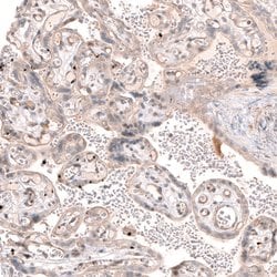 Invitrogen SMC6 Polyclonal Antibody 100 &mu;L; Unconjugated:Antibodies,