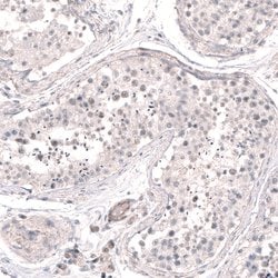 Invitrogen SMC6 Polyclonal Antibody 100 &mu;L; Unconjugated:Antibodies,