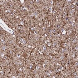 Invitrogen ENPP6 Polyclonal Antibody 100 &mu;L; Unconjugated:Antibodies,