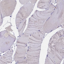 Invitrogen ENPP6 Polyclonal Antibody 100 &mu;L; Unconjugated:Antibodies,