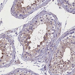 Invitrogen ENPP6 Polyclonal Antibody 100 &mu;L; Unconjugated:Antibodies,