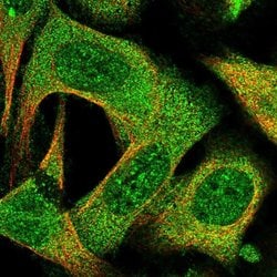 Invitrogen MRI1 Polyclonal Antibody 100 &mu;L; Unconjugated:Antibodies,
