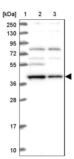 Invitrogen MRI1 Polyclonal Antibody 100 &mu;L | Buy Online | Invitrogen&trade; | Fisher Scientific