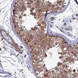 RIC8B Polyclonal Antibody:Antibodies, Polyclonal