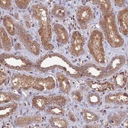 RIC8B Polyclonal Antibody:Antibodies, Polyclonal