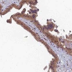 RIC8B Polyclonal Antibody:Antibodies, Polyclonal