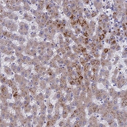 Adenylate Kinase 4 Polyclonal Antibody:Antibodies, Polyclonal
