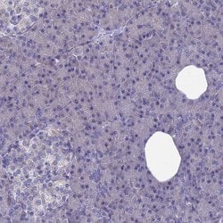Adenylate Kinase 4 Polyclonal Antibody:Antibodies, Polyclonal