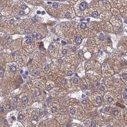 Adenylate Kinase 4 Polyclonal Antibody:Antibodies, Polyclonal