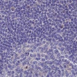 Adenylate Kinase 4 Polyclonal Antibody:Antibodies, Polyclonal
