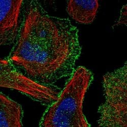 Invitrogen CBWD1 Polyclonal Antibody 100 &mu;L; Unconjugated:Antibodies,