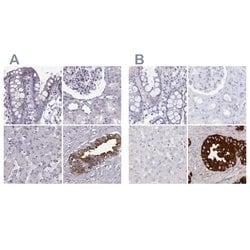 Invitrogen SEMG2 Polyclonal Antibody 100 &mu;L; Unconjugated:Antibodies,