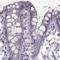 Invitrogen SEMG2 Polyclonal Antibody 100 &mu;L; Unconjugated:Antibodies,