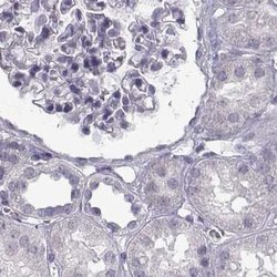 Invitrogen SEMG2 Polyclonal Antibody 100 &mu;L; Unconjugated:Antibodies,