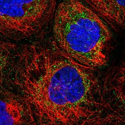 Invitrogen NDUFB9 Polyclonal Antibody 100 &mu;L; Unconjugated:Antibodies,