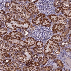 Invitrogen NDUFB9 Polyclonal Antibody 100 &mu;L; Unconjugated:Antibodies,