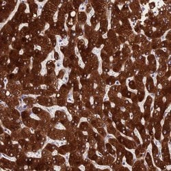 Invitrogen PPP2R2D Polyclonal Antibody 100 &mu;L; Unconjugated:Antibodies,