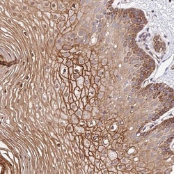 Invitrogen TRIM43 Polyclonal Antibody 100 &mu;L; Unconjugated:Antibodies,