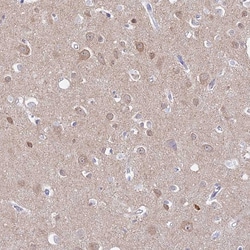 Invitrogen GPR123 Polyclonal Antibody 100 &mu;L; Unconjugated:Antibodies,