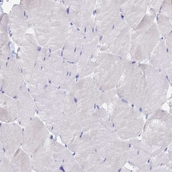Invitrogen GPR123 Polyclonal Antibody 100 &mu;L; Unconjugated:Antibodies,