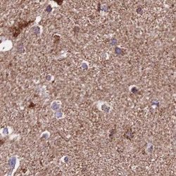 Invitrogen ATP5H Polyclonal Antibody 100 &mu;L; Unconjugated:Antibodies,