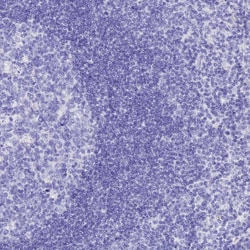 Invitrogen ISCA1 Polyclonal Antibody 100 &mu;L; Unconjugated:Antibodies,
