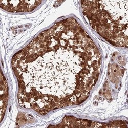 Invitrogen FAM53C Polyclonal Antibody 100 &mu;L; Unconjugated:Antibodies,