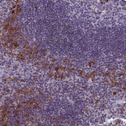 Invitrogen CNEP1R1 Polyclonal Antibody 100 &mu;L; Unconjugated:Antibodies,