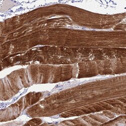 Invitrogen ZNF837 Polyclonal Antibody 100 &mu;L; Unconjugated:Antibodies,